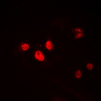 Anti-HEN1/2 Antibody