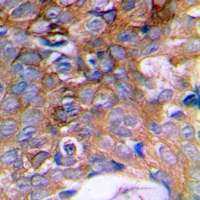 Anti-HIBADH Antibody