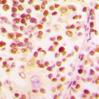 Histone H2B Rabbit Polyclonal Antibody