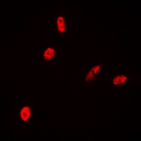 Histone H2B Rabbit Polyclonal Antibody