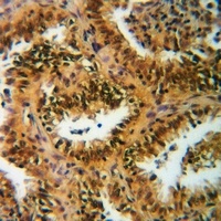 Anti-Histone H3 (Acetyl-K123) Antibody