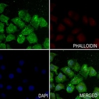 Anti-Histone H3 (Acetyl-K123) Antibody