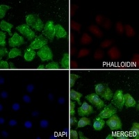 Histone H3 (AcK123) antibody