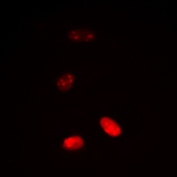 Histone H3 (Acetyl-K18) Antibody
