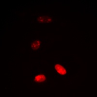 Histone H3 (AcK18) antibody