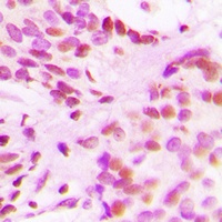 Anti-Histone H3 (Acetyl-K27) Antibody