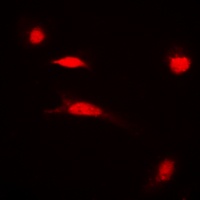 Anti-Histone H3 (Acetyl-K27) Antibody