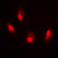 Histone H4 (AcK8) antibody