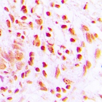 Anti-Histone H4 (Acetyl-K16) Antibody