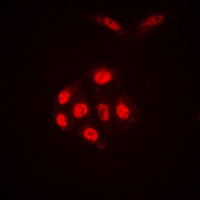 Histone H4 (AcK16) antibody