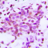 Hexokinase 1 Rabbit Polyclonal Antibody