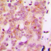 Anti-HLA-H Antibody