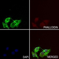 Anti-HLA-H Antibody
