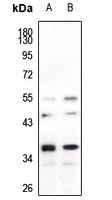 hnRNP A2/B1 Antibody