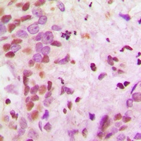 hnRNP A2/B1 Antibody