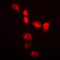 hnRNP A2/B1 Antibody