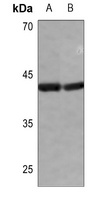 hnRNP D0 Antibody