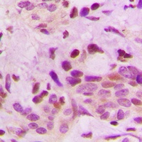 hnRNP D0 Antibody