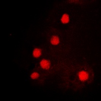 Anti-HOXC6 Antibody