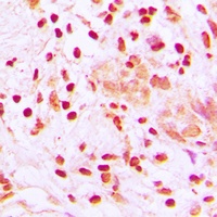 Anti-HSF1 Antibody