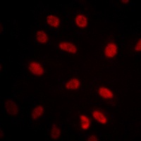 Anti-HSF1 Antibody