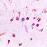 Anti-HSF1 (Phospho-S303) Antibody