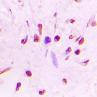 HSF1 (phospho-S303) antibody