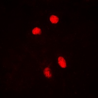 HSF1 (phospho-S303) antibody