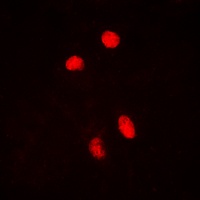 Anti-HSF1 (Phospho-S303) Antibody