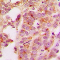 Anti-HSP70 Antibody