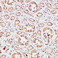 Anti-IGFBP3 Antibody