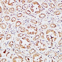 IGFBP3 antibody