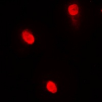 AIOLOS Antibody