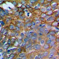 IL-12A Antibody