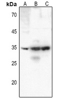 CD25 Antibody