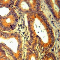 Anti-IL-1F5 Antibody
