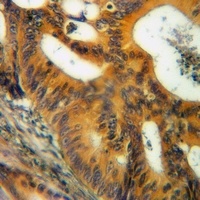 Anti-CD124 Antibody