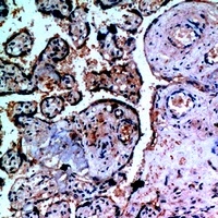 Anti-Inhibin alpha Antibody