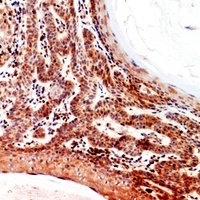 Anti-Inhibin beta B Antibody