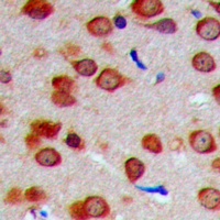 Anti-INPP5J Antibody
