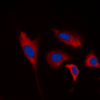 Anti-INPP5J Antibody