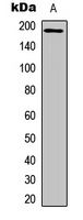 IRS1 Rabbit Polyclonal Antibody