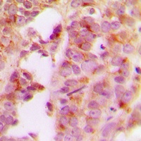 IRS1 Rabbit Polyclonal Antibody