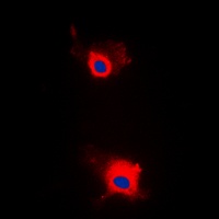 IRS1 (phospho-S636) antibody