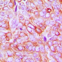 CD61 (Phospho-Y773) Antibody