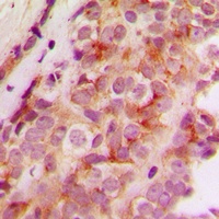 Anti-JMY Antibody