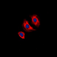VEGFR2 (phospho-Y1175) antibody