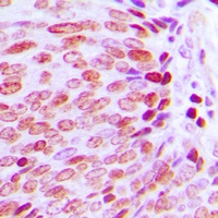 Anti-KLF10/11 Antibody