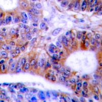 Cytokeratin 20 antibody