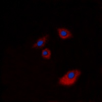 Anti-Cytokeratin 20 Antibody